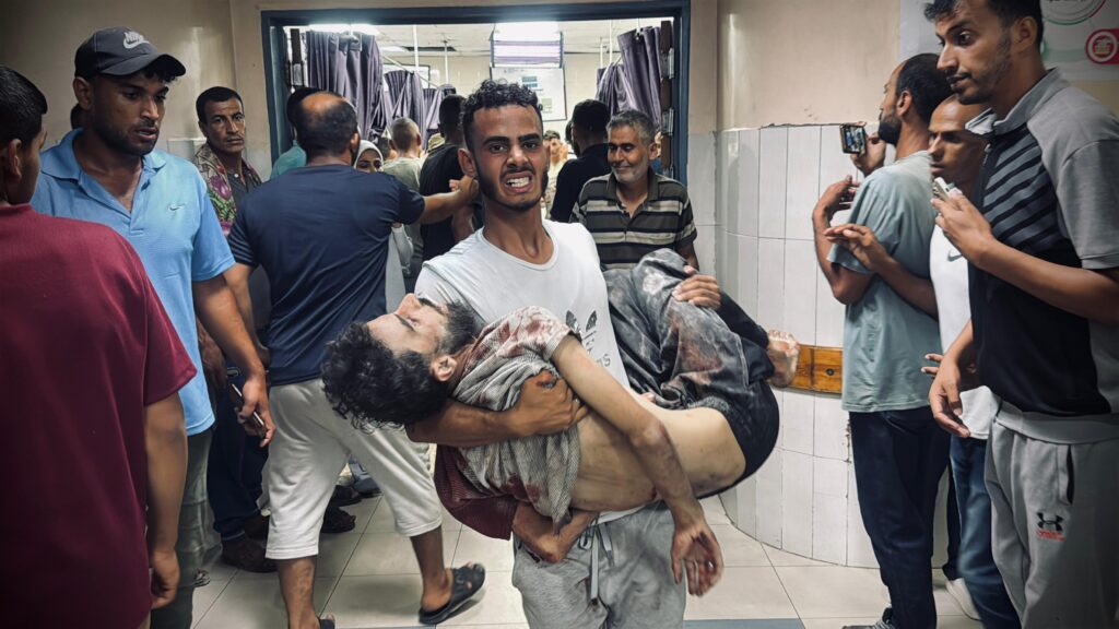 Abdullah Hammad, pracownik Lekarzy bez Granic, jest niesiony korytarzem w szpitalu Nassera. Został ranny, czekając na ciężarówkę z pomocą humanitarną w Chan Junus. Zmarł na skutek odniesionych ran. Jego rodzina wyraziła zgodę na publikację zdjęcia.