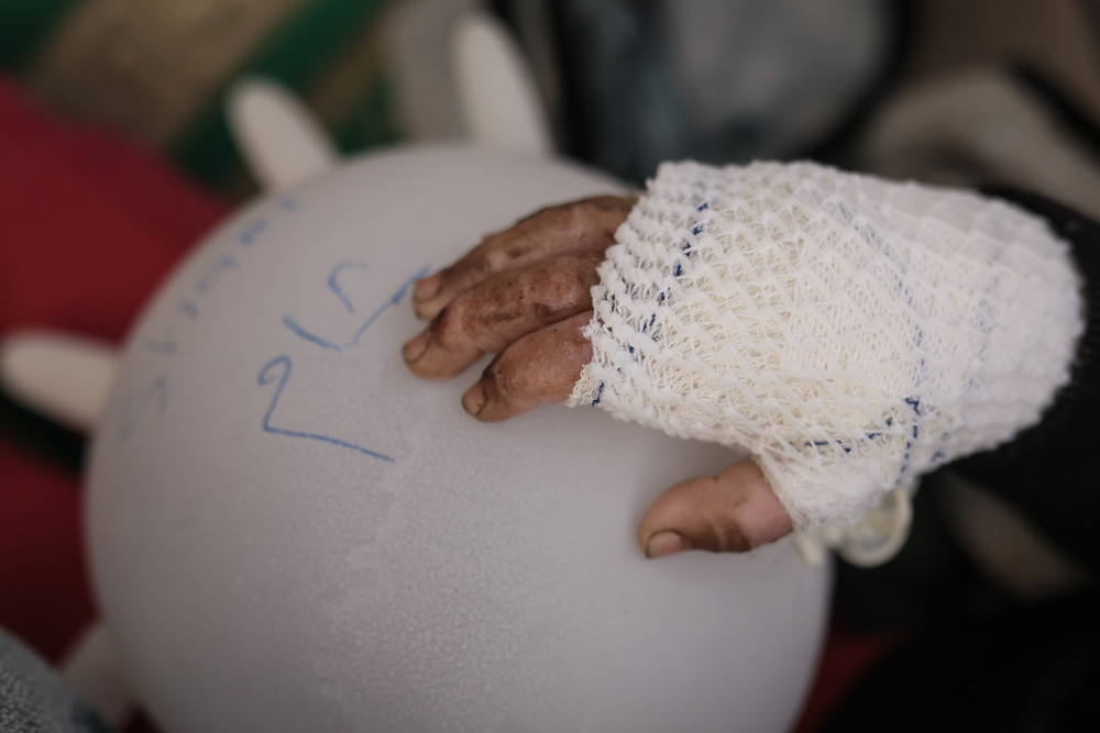 Po założeniu opatrunku 4-letniej Sham, pielęgniarz zrobił z rękawiczki balonik i napisał na nim jej imię. Strefa Gazy, 2024